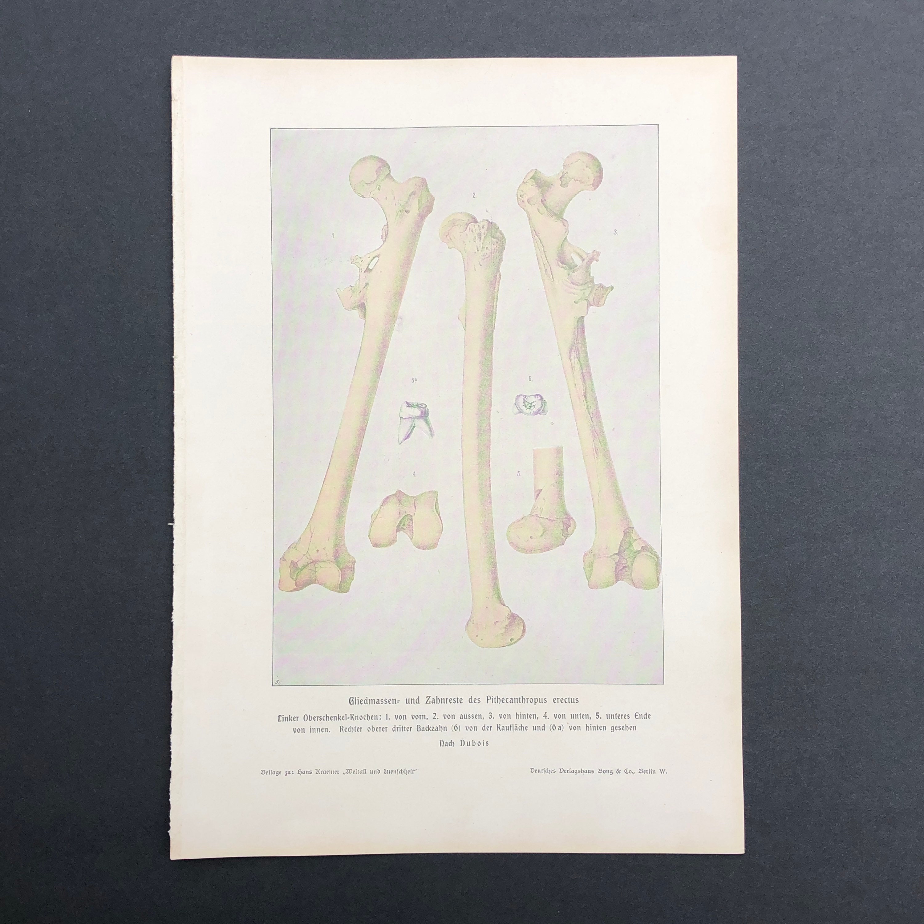 C. 1900 BONES PRINT - Antique Anatomy Print - Human Skeleton Print ...
