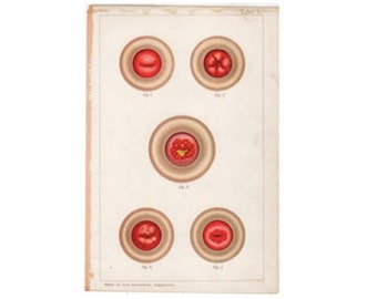 c. 1902 Litografía del CÉRVIX • impresión antigua original • impresión del útero • obstetricia y ginecología • úteros • anatomía médica • sistema reproductivo • salud de la mujer