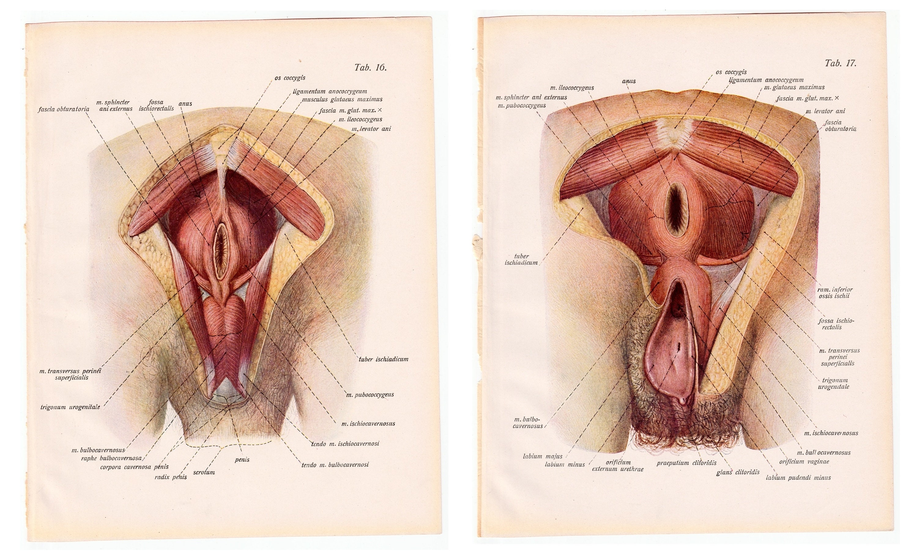 【ラプンツェル様用】ATAVISM / PUTREFIED GENITALIA Traumatophora triscalpta (Martens, 1875). Genitalia