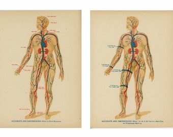 c. 1903 ACCIDENTS & EMERGENCIES lithographs - medical anatomy - original antique prints - dog bite - poisonous reptile - bleeding - set of 2