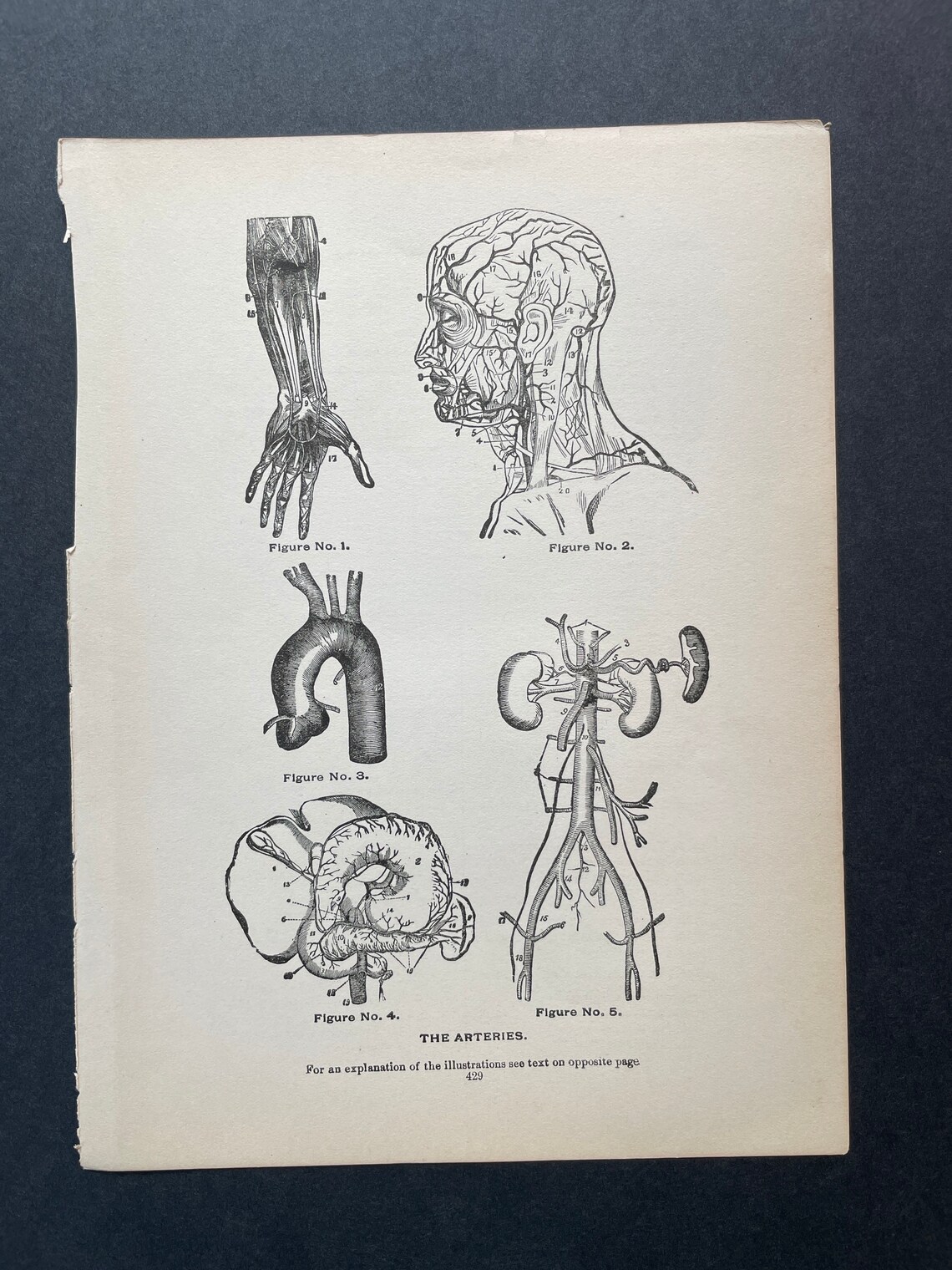 C. 1901 ANTIQUE ANATOMY PRINTS - Set of 4 Original Antique Medical ...