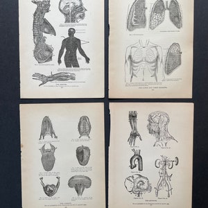C. 1901 ANTIQUE ANATOMY PRINTS - Set of 4 Original Antique Medical ...