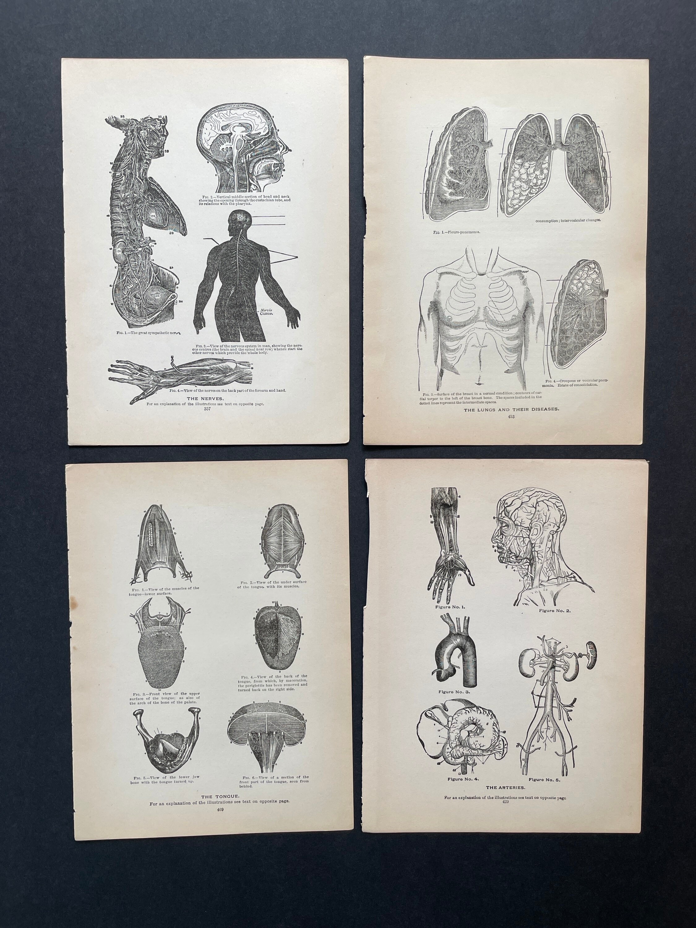 C. 1901 ANTIQUE ANATOMY PRINTS - Set of 4 Original Antique Medical ...