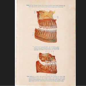 c. 1926 HUMAN TEETH lithograph • original antique print • medical illustration • human anatomy • dentist • teeth of an adult and a child