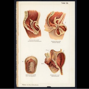 c. 1902 FEMALE ANATOMY lithograph • original antique print • OBGYN • medical illustration • women’s health • reproductive system • cervvix