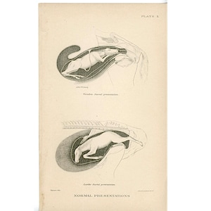 c. 1907 FOAL IN UTERO lithograph • original antique print • horse anatomy print • equine medicine • horse fetus • normal position in womb