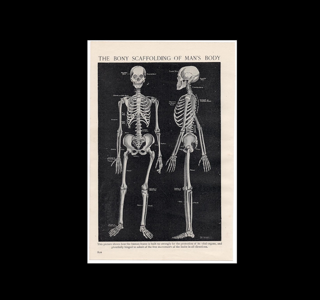SKELETON Lithograph C. 1910 • Original Antique Print • Human Anatomy ...
