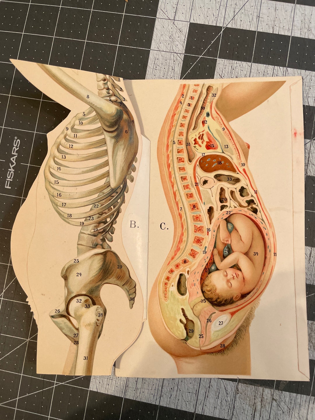 C. 1902 PREGNANT FEMALE ANATOMY Lithograph • Interactive Medical  Illustration - Human Anatomy Print - Muscle Layers - Skeleton - Fetus - Etsy, image size:1080x1440