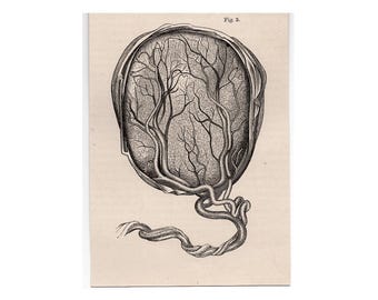 リンダ.ル.キンフ.リトグラフ、リトグラフ、マタニティーカラーリトグラフ リンダ.ル.キンフ.リトグラフ、リトグラフ、マタニティーカラー