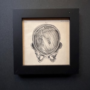 framed c.1860 FETUS AMNIONIC SAC lithograph • original antique print • female anatomy • Mother&#39;s Day • pregnant • in utero • baby in womb