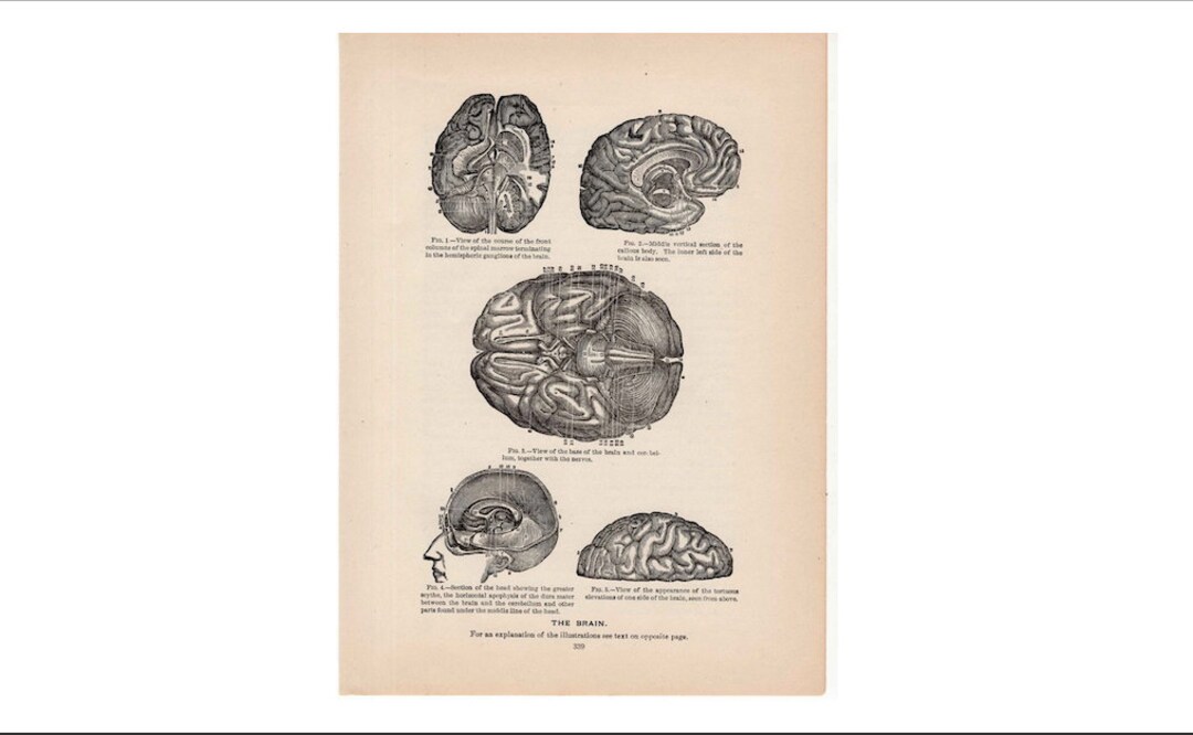 BRAIN ANATOMY Antique Print C. 1901 • Original Antique Lithograph ...