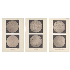 May include: Three vintage scientific prints featuring black and white circular microscopic images. Each page contains two circular diagrams with labels including 'ISO-CHOLERA', 'SWINE-PLAGUE', and 'ISO-CHOLERA AND SWINE-PLAGUE' printed in black text.