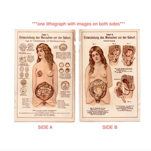 c. 1929 EMBRYO DEVELOPMENT lithograph • original antique print • fetus print • pregnant woman • baby in womb • prenatal • OBGYN • two sided!