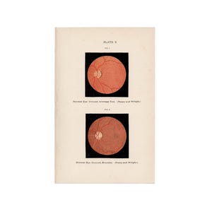 c. 1910 EYE ANATOMY print • original antique print • medical illustration • Ophthalmology • optometry • eye doctor • normal eye ground