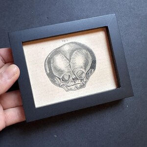 May include: A framed black and white illustration of a fetal skull, labeled "Fig. 1". The artwork is set against a tan background and encased in a simple black frame, creating a vintage aesthetic.