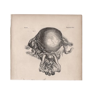 c. 1860 WOMB print • original antique print • fetus anatomy • pregnant mother • in utero • birthing print • Mother&#39;s Day gift • uterus print
