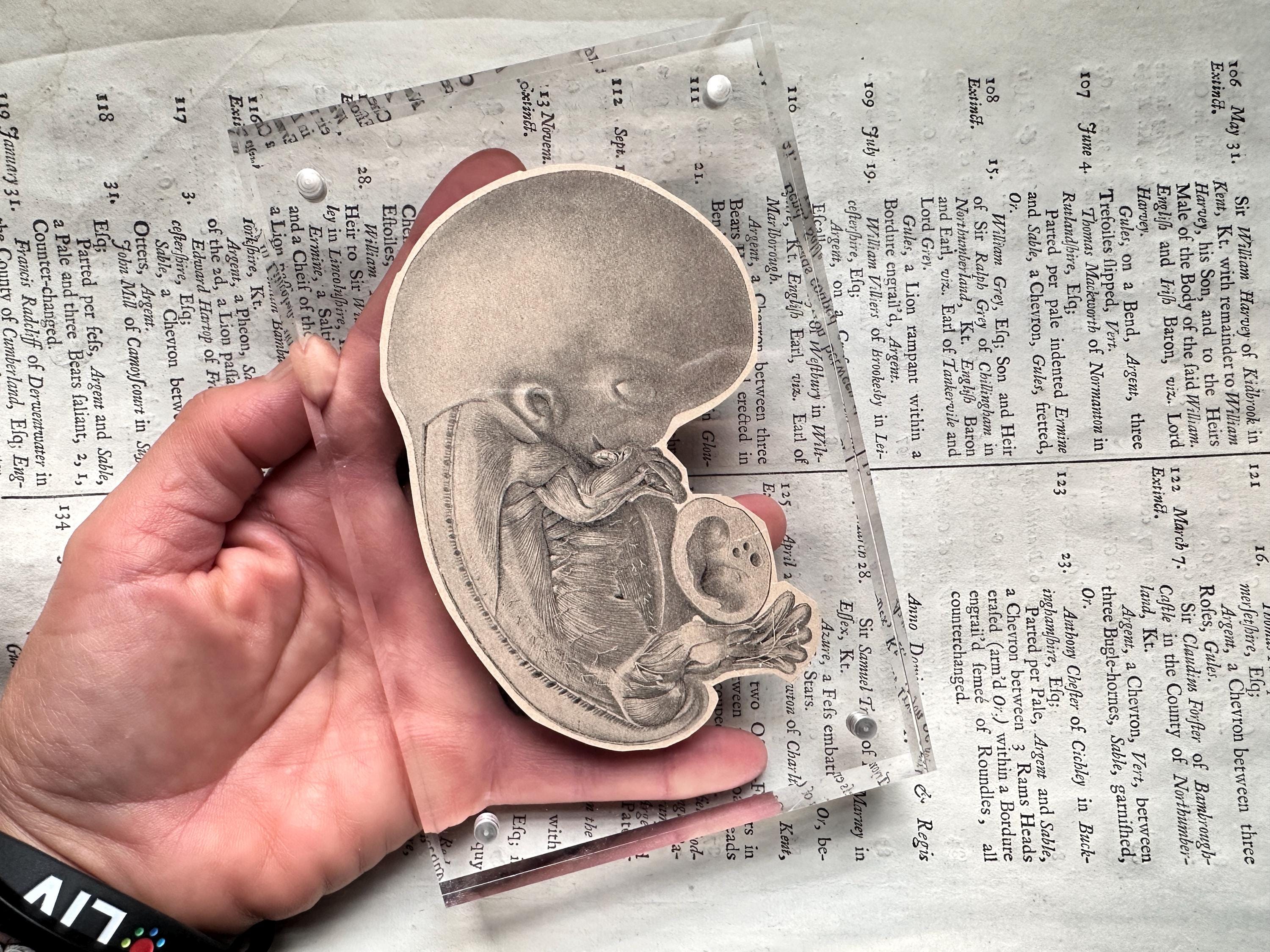 framed ANTIQUE FETUS PRINT C. 1900 * original antique print * medical illustration * fetal anatomy * baby in utero * in acrylic frame 4 x 6"