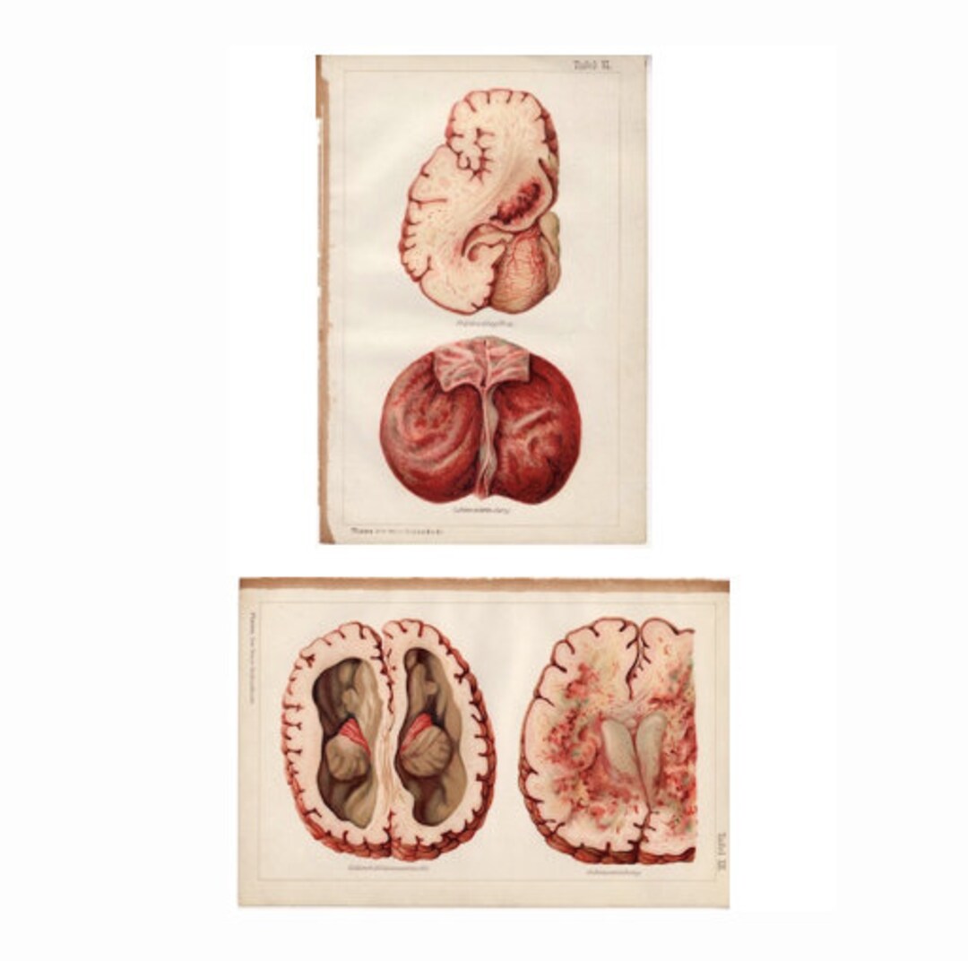 C.1902 BRAIN ANATOMY Prints - Set of 2 Antique Human Anatomy Prints ...