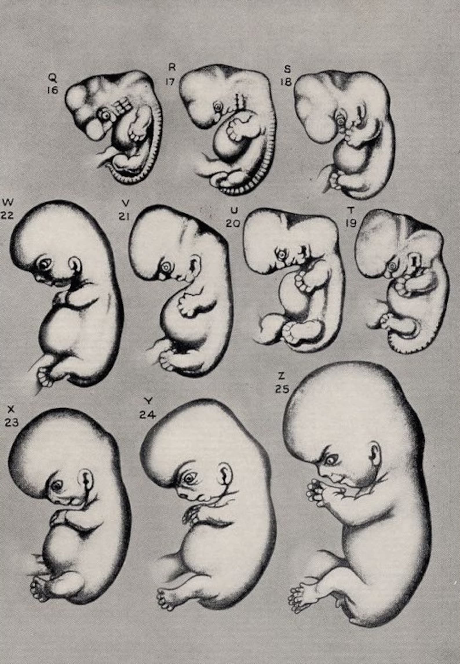 1934 HUMAN EMBRYO print original antique medical anatomy | Etsy