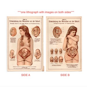 c. 1929 EMBRYO DEVELOPMENT lithograph • original antique print • fetus print • pregnant woman • baby in womb • prenatal • OBGYN • two sided!