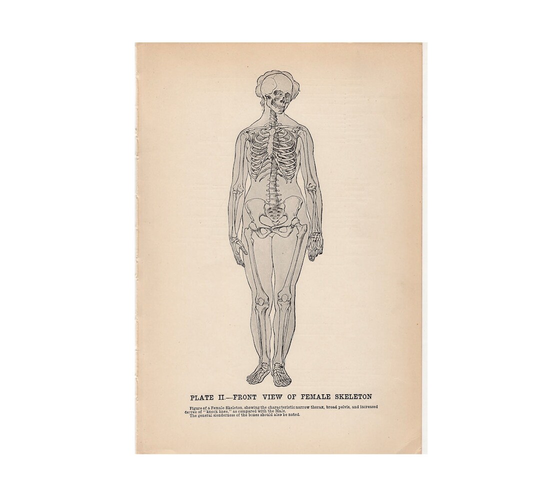 C. 1917 FEMALE SKELETON Lithograph • Original Antique Print • Halloween ...