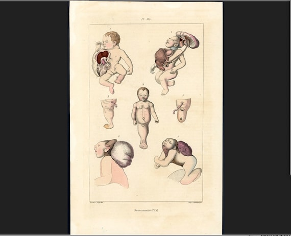 Human Deformities Pictures