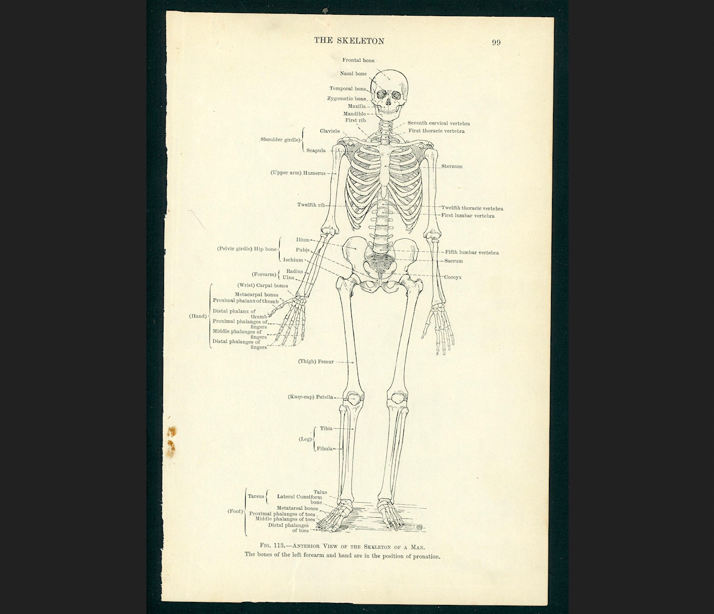 C. 1937 SKELETON • FRONT & BACK Lithograph • Original Vintage Print ...