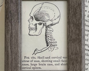 Frontal View of Human Skull, 1917 (lithograph) For sale as Framed