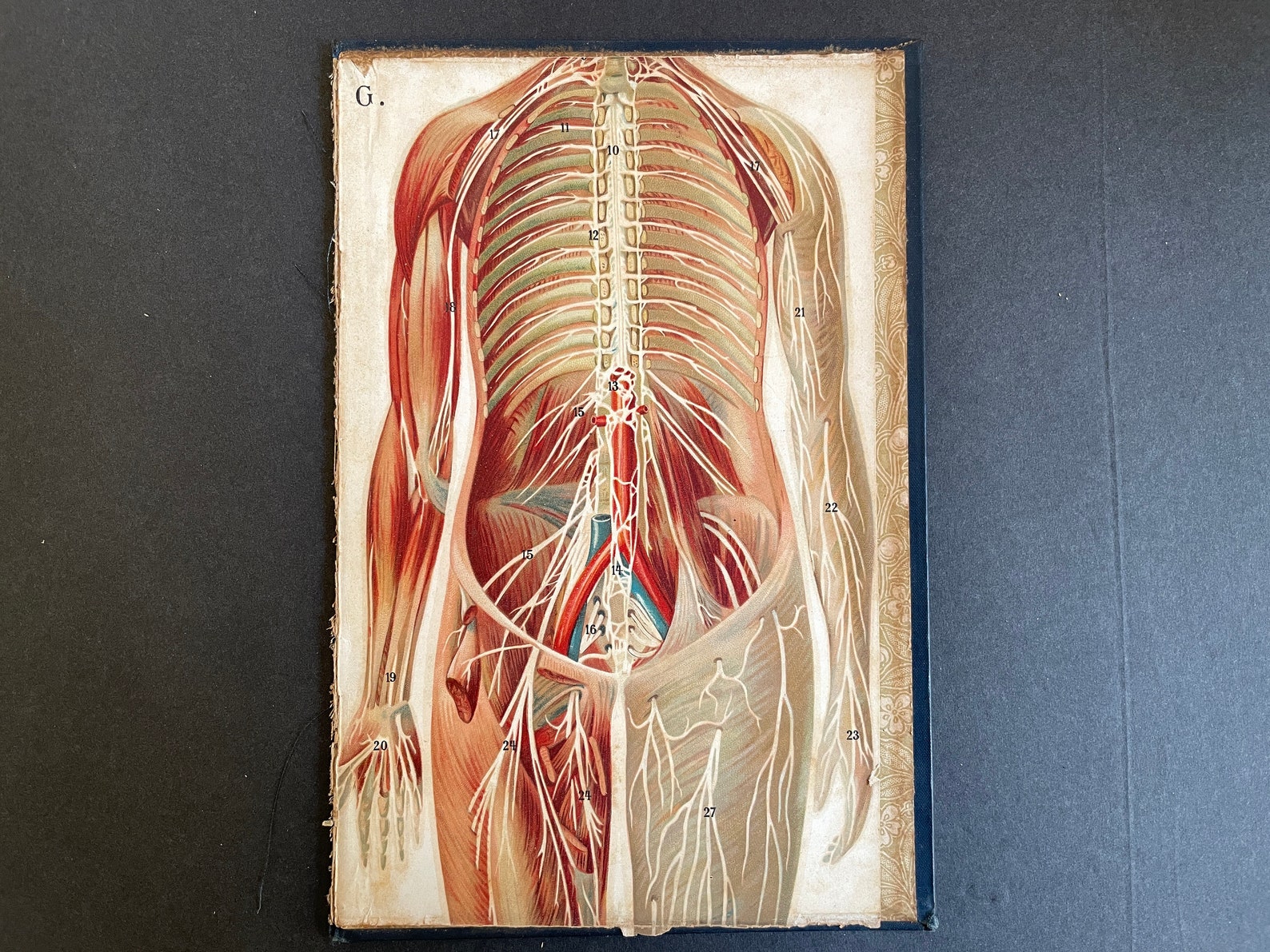 C. 1902 FEMALE ANATOMY Lithograph - Original Antique Print • Antique ...