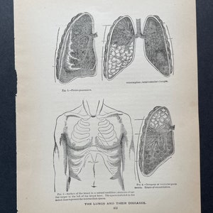C. 1901 ANTIQUE ANATOMY PRINTS - Set of 4 Original Antique Medical ...