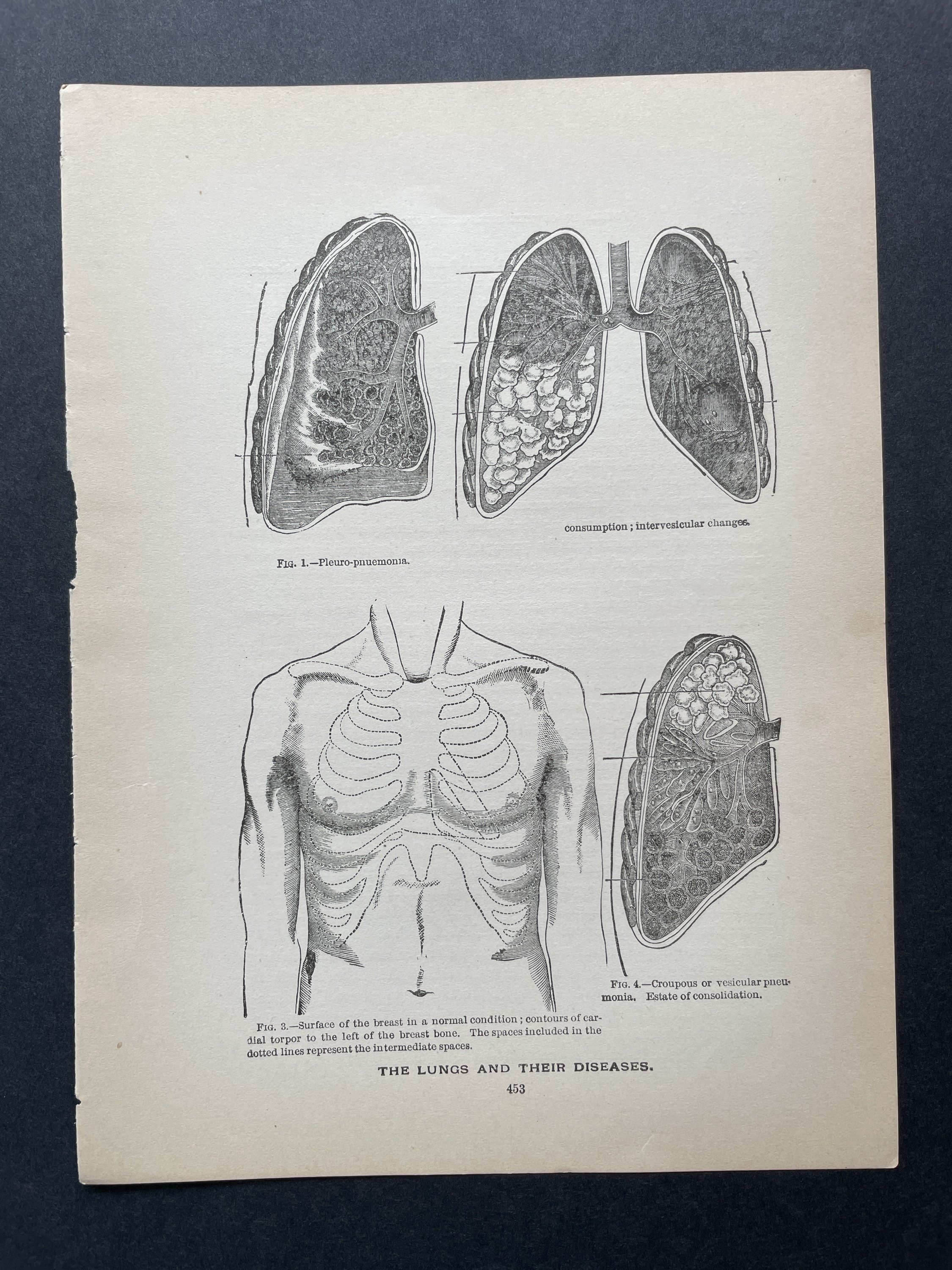 C. 1901 ANTIQUE ANATOMY PRINTS - Set of 4 Original Antique Medical ...