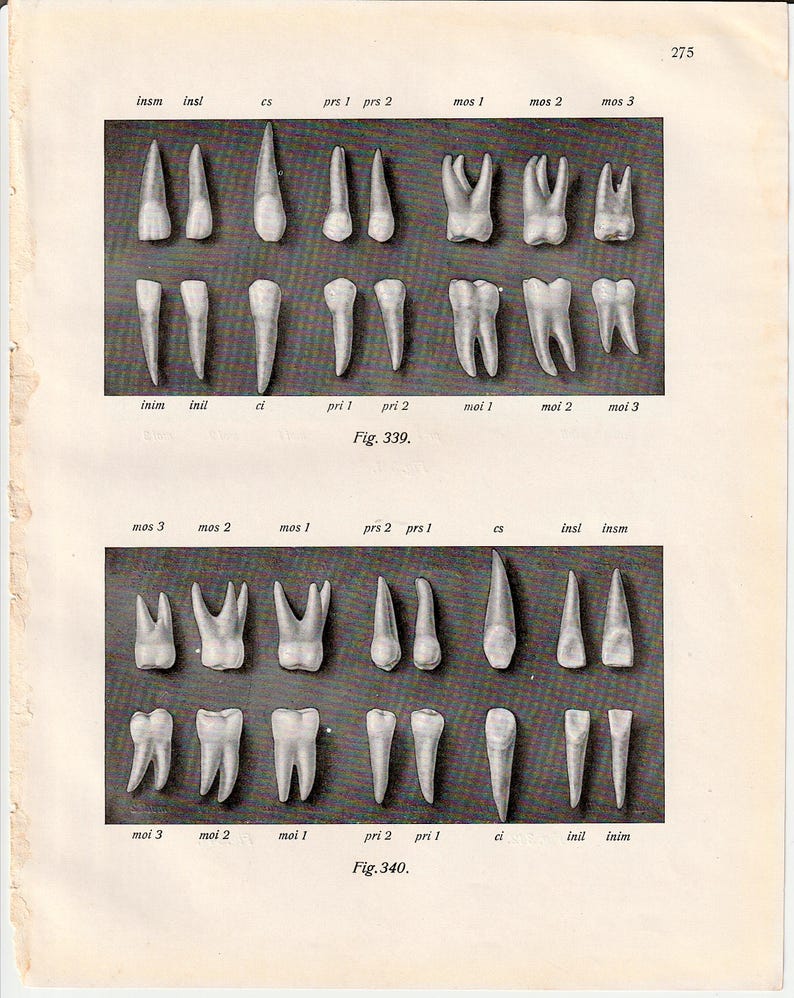 Molar Labels TEETH Lithograph C. 1928 • Original Antique Print • Mouth Anatomy Print ...