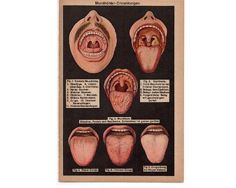 c. Lithographie de 1929 BOUCHE, DENTS ET LANGUE • gravure ancienne originale • illustration médicale • anatomie buccale • dentiste • molaires • dent •