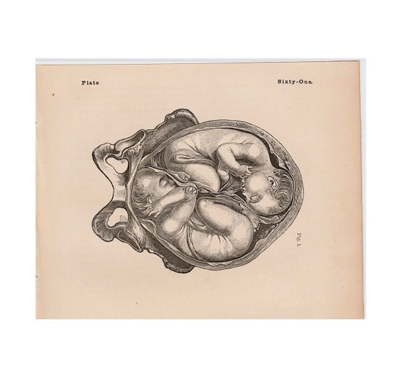 絵画 the memory in the womb Womb by leonardo da vinci hi-res stock photography and