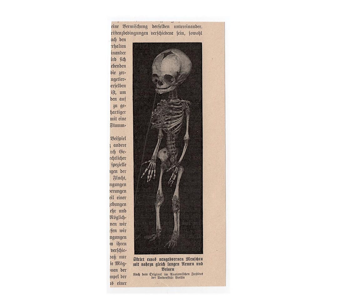FETAL SKELETON Lithograph C.1900 • Original Antique Print • Human ...