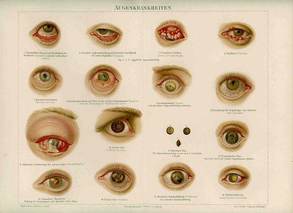 Eye Diseases Chart