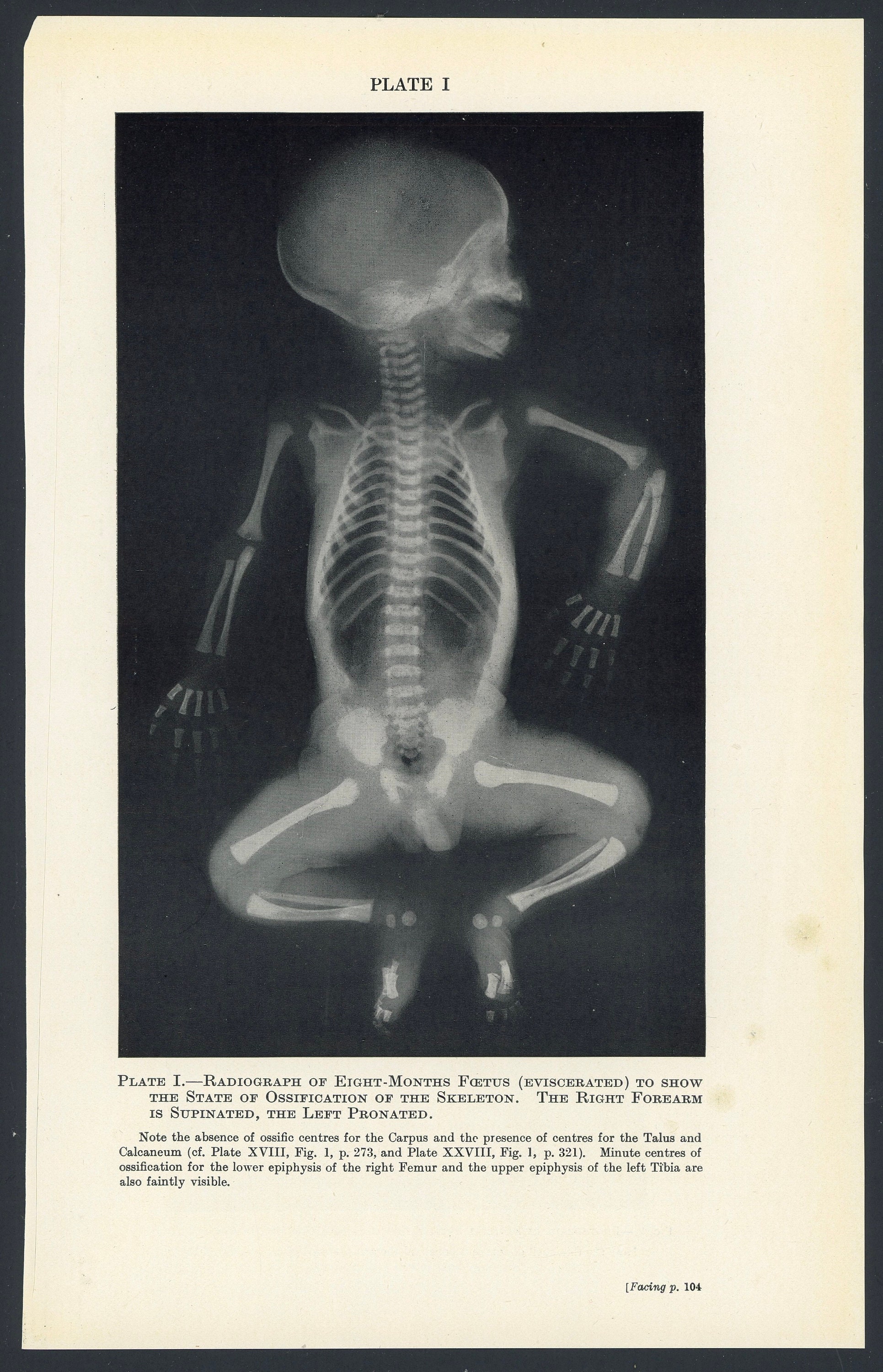 C. 1937 FETUS XRAY Lithograph • Original Vintage Print • Fetal