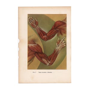 Puede incluir: Ilustración anatómica vintage de la extremidad superior, que muestra la estructura muscular y ósea detallada. La obra de arte presenta dos vistas del brazo, con un enfoque en los músculos y tendones. El texto en la parte inferior dice "Plate 11 Upper extremity - dissection."