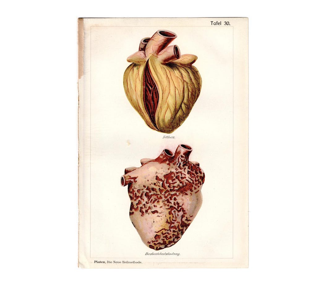 C. 1902 HUMAN HEART Lithograph • Original Antique Print • Human Anatomy ...