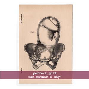 c. 1860 BABY IN WOMB lithograph • original antique print • fetus anatomy • pregnant mother • in utero • birthing print • Mother&#39;s Day gift