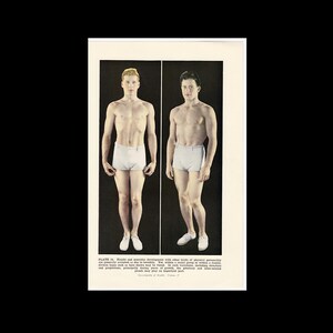 May include: A black and white image of two men standing side by side. Both men are wearing white briefs and have their arms at their sides. The men are facing forward and have different hairstyles. The image is from a medical textbook and includes the text "PLATE 36. Height and muscular development, with other traits of physical personality are generally conceded to be hereditary. Yet within a family, including diverse types, as here shown, may be found. In such variations, including structure and proportions, each gland may play an important part."