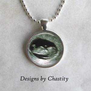 Peut inclure: Un pendentif circulaire argenté avec une image échographique en noir et blanc d'un fœtus à l'intérieur du cadre. Le pendentif est suspendu à une chaîne à billes argentée. Le texte "Designs by Chastity" est imprimé sous le pendentif.