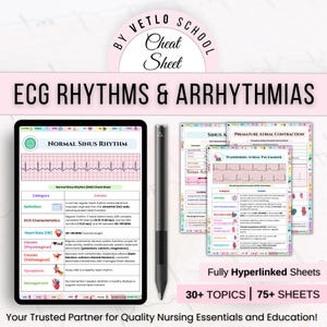 Aide-mémoire pour l'ECG, rythmes et arythmies, 75+, guide d'étude ECG, notes pour les infirmières, aide-mémoire médical, étudiant en soins infirmiers, autocollants ou pages de couverture gratuits