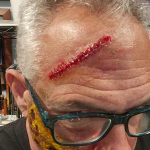 Puede incluir: Primer plano de un rostro con maquillaje de efectos especiales. Una herida cosida y sangrienta está en la frente. Maquillaje amarillo y rojo simula una lesión cutánea en la mejilla y la mandíbula. La persona lleva gafas con montura azul.