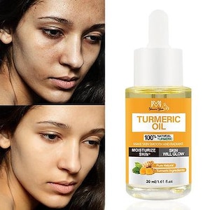 K&ouml;nnte beinhalten: Vorher-Nachher-Vergleich eines Frauengesichts, neben einer Flasche Kurkuma&ouml;l. Die &Ouml;lflasche hat eine wei&szlig;e Pipette und ein gelbes Etikett mit dem Text "TURMERIC OIL" und "100% NATURAL TURMERIC". Die Flasche ist 30 ml.