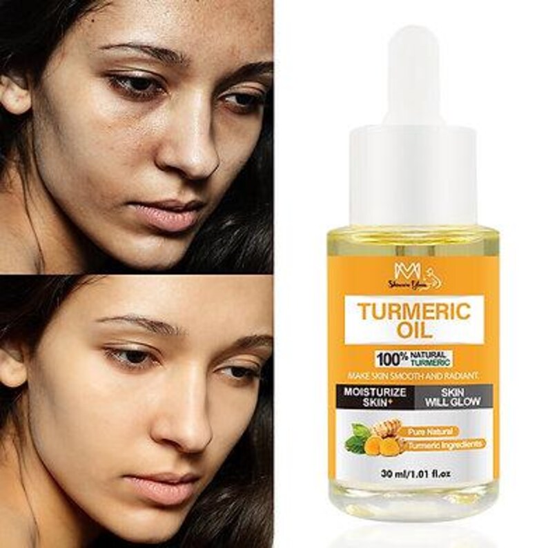 K&ouml;nnte beinhalten: Vorher-Nachher-Vergleich eines Frauengesichts, neben einer Flasche Kurkuma&ouml;l. Die &Ouml;lflasche hat eine wei&szlig;e Pipette und ein gelbes Etikett mit dem Text "TURMERIC OIL" und "100% NATURAL TURMERIC". Die Flasche ist 30 ml.