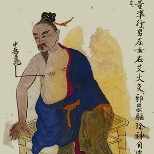antique illustration the malign attack acupuncture chart digital download