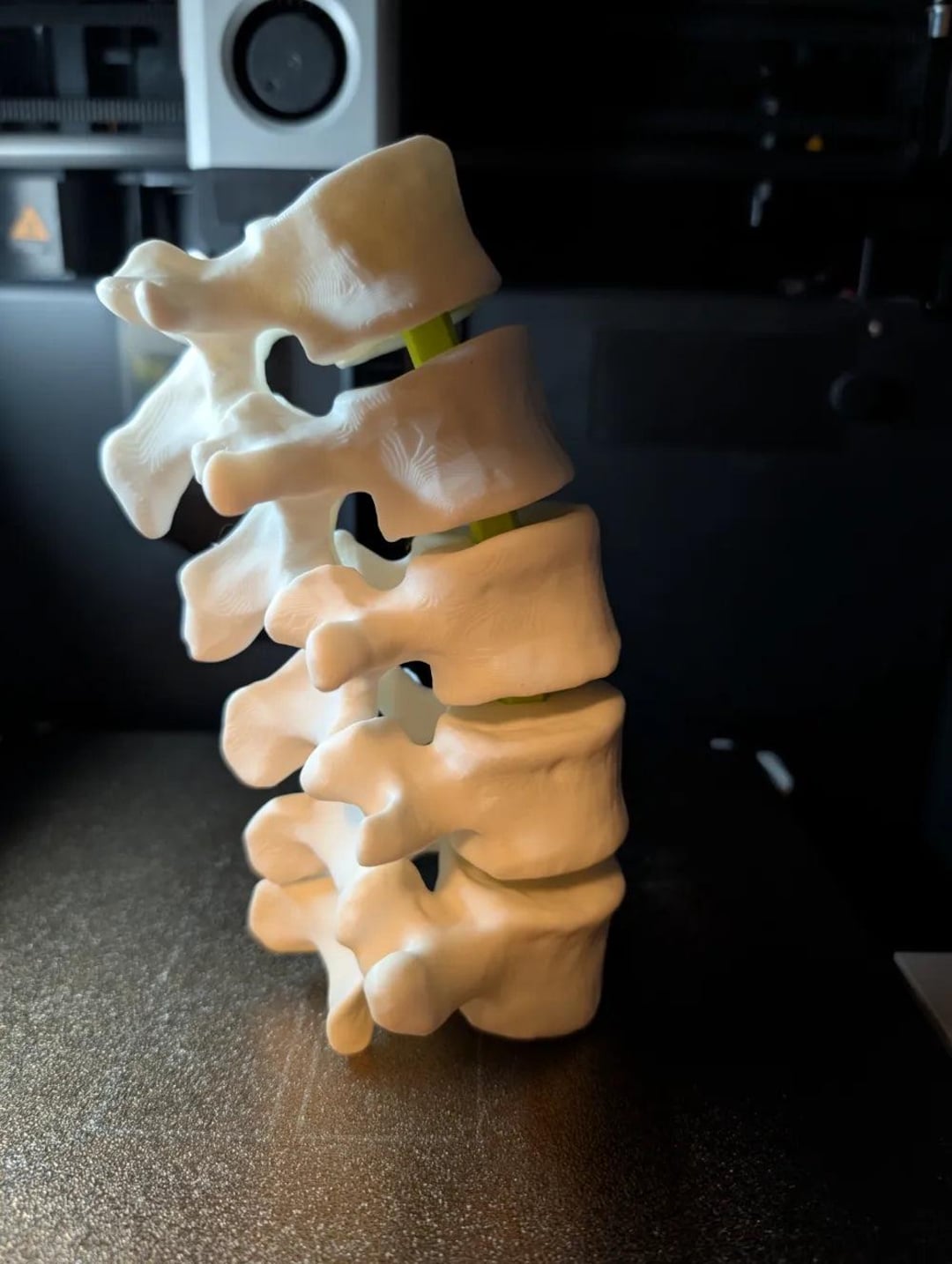 Articulating Lumbar Vertebrae - 3D Printed Spinal Anatomy Model ...