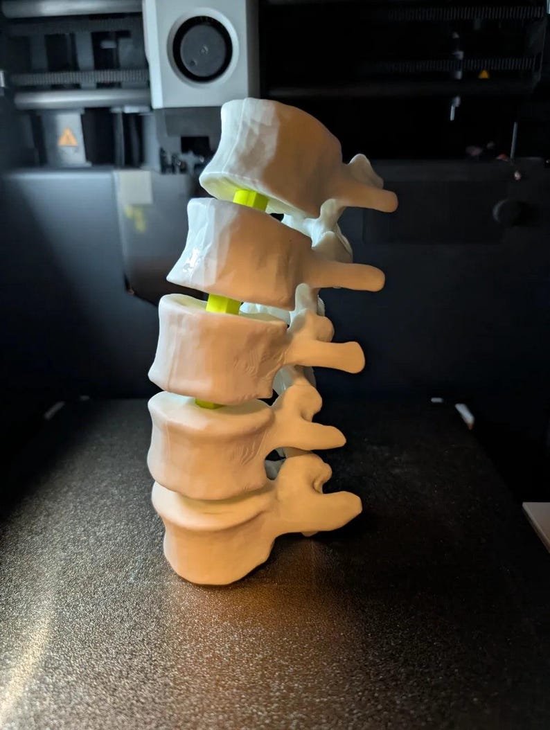 Articulating Lumbar Vertebrae - 3D Printed Spinal Anatomy Model ...