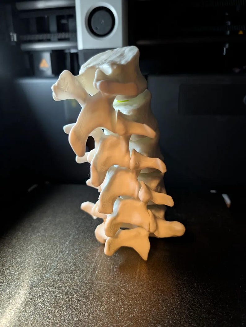 Articulating Lumbar Vertebrae - 3D Printed Spinal Anatomy Model ...